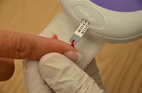 testing finger glucose discard first drop|discard first blood test.